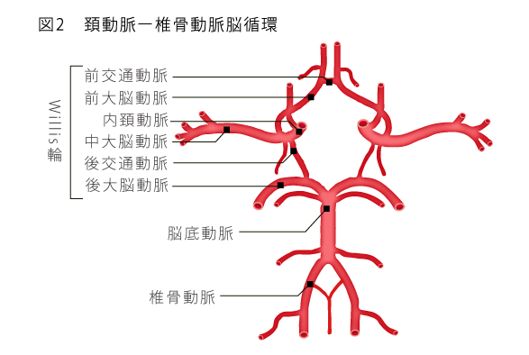 脳 動脈 瘤 消える