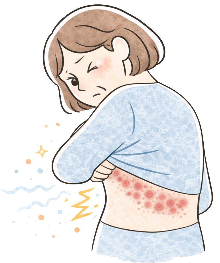 帯状疱疹イラスト